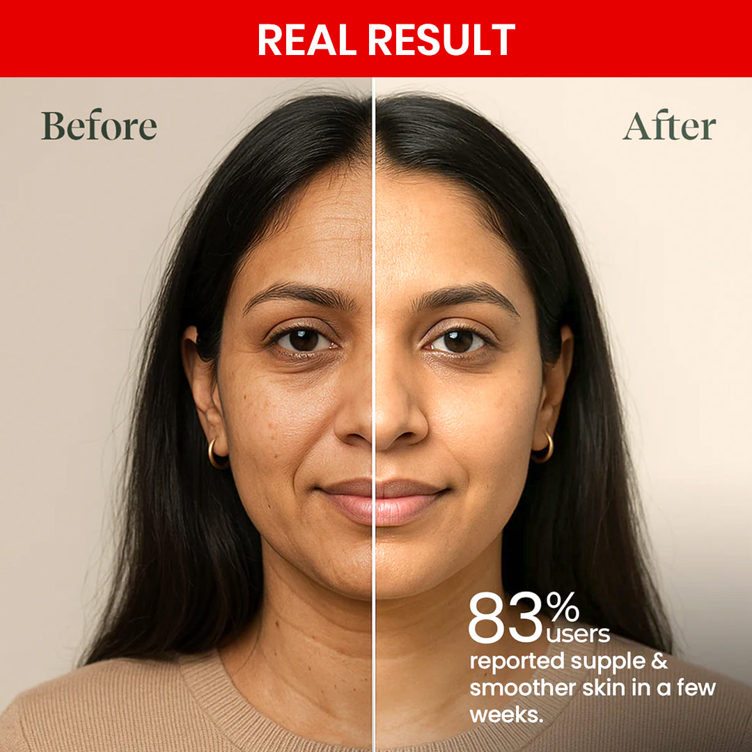 Retinol Pro Night Cream 0.1% with Collagen & Peptides – 30g | Anti-Aging & Skin Renewal Formula for Fine Lines, Wrinkles & Uneven Texture