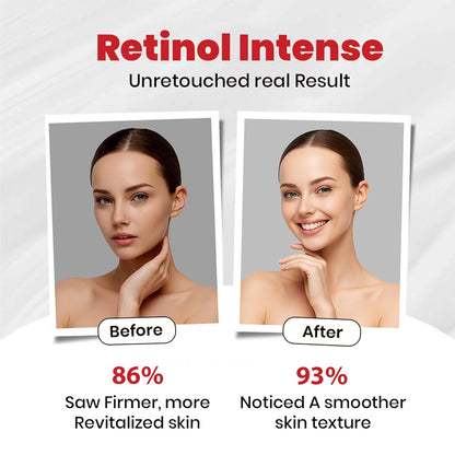 Unleashing the Power of Retinol: Why Bio Mystery Retinol Intense Cream 0.1% is Your Ultimate Nighttime Skincare Solution ( 40g )