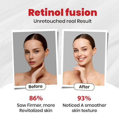 Unlock Youthful Skin: How Retinol Fusion Cream 0.05% Transforms Your Nighttime Skincare Routine ( 40g )
